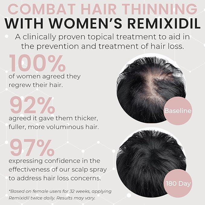 2% Minoxidil for Women Hair Regrowth Spray– Minoxidil Thicker & Fuller Topical Solution for Hair Loss Treatment, Follicle Reactivation, Clinically Proven Formula - 60 ml