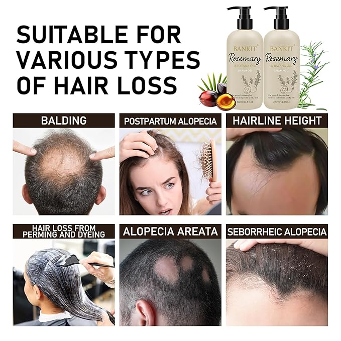 BANKIT Rosemary Batana Hair Growth Shampoo – Anti Hair Loss & Thickening Shampoo for Women & Men – Keratin Formula for Healthy Scalp & Fuller Hair(1 Pack)