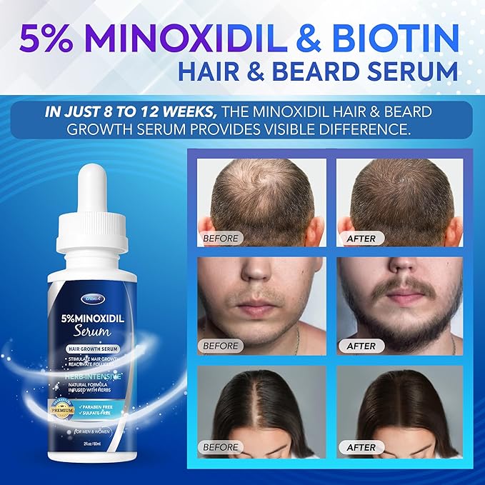 5% Minoxidil Hair Growth for Men and Women: Extra Strength Minoxidil and Biotin Beard Regrowth Serum for Thinning Hair Loss to Grow Thicker Fuller Hair 60ml 4 Bottles