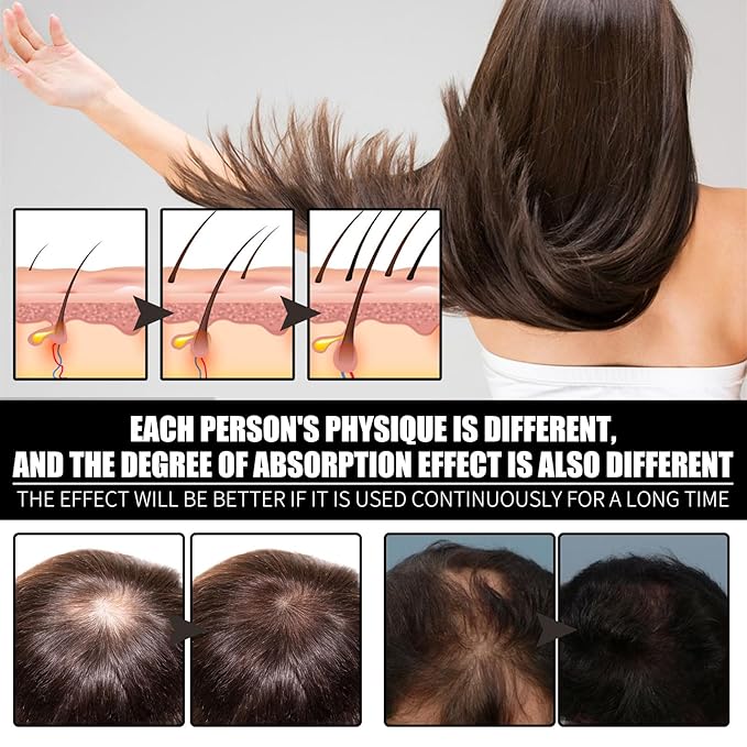 Hair Care Oil with Biotin and Collagen, Scalp Nourishing Treatment for Hair Loss Prevention and Root Strengthening, Suitable for Men and Women