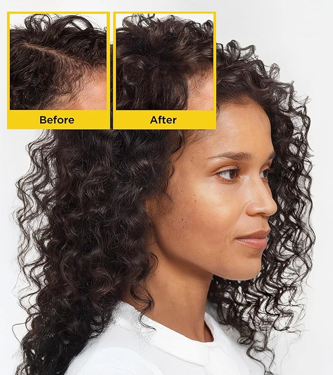 Root Activator Biotin Hair Growth Shampoo, Nourishing Tames Frizz with HA&B5, Anti Dandruff Rosemary Shampoo Batana Oil Dht Blocker,Organic Sulfate Free Hair Care Men Women 10.14 Fl Oz