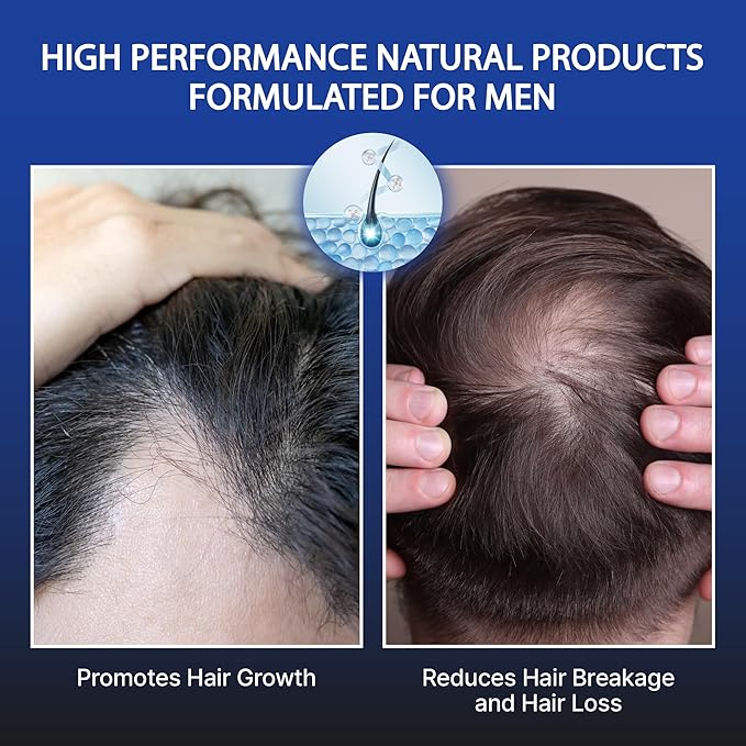 RED Pro GROOMANE Men Hair Conditioner with Biotin & Caffeine, Thickening, Anti-Hair-Loss Care, Moisturizes Scalp, Strengthen, Menthol Cooling, Sulfate- & Paraben-Free, Fuller-Looking Hair