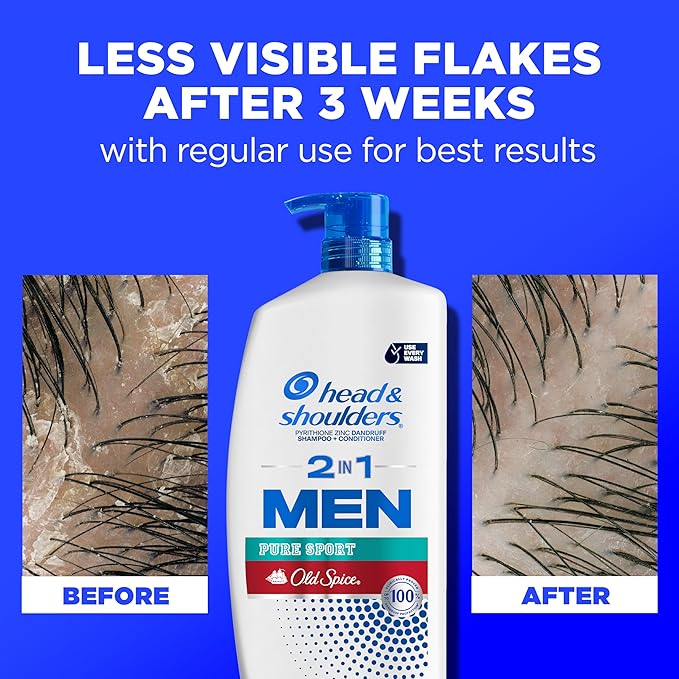 Head & Shoulders Mens Anti-Dandruff Shampoo and Conditioner with 1% Pyrithione Zinc, Old Spice Pure Sport Men's 2-in-1 Twin Pack, Shampoo for Men, 31.4 fl oz Each