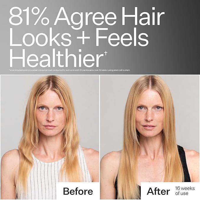 ACT+ ACRE Stem Cell Conditioner | Strengthens Ends, Adds Shine, Hydrates Fine Hair | Apple Stem Cells, Castor Oil, Antioxidants | Lightweight, Vegan, Cold Processed®, Color Safe | 10 Fl Oz