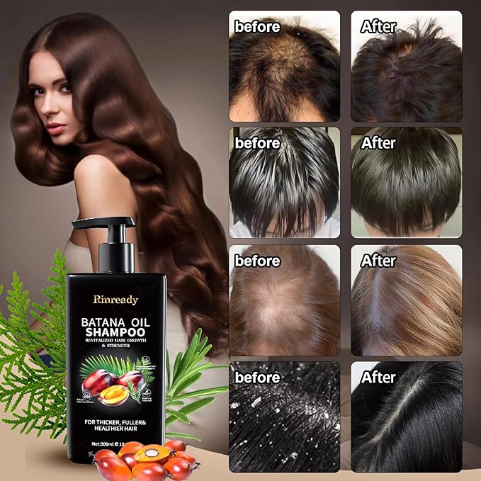 2 Packs Batana Oil & Rosemary Shampoo for Hair Growth, Hair Treatment for Thinning Hair, Anti Hair Loss Care, Strengthens Roots, Sulfate Free for Women & Men 10.15 fl oz