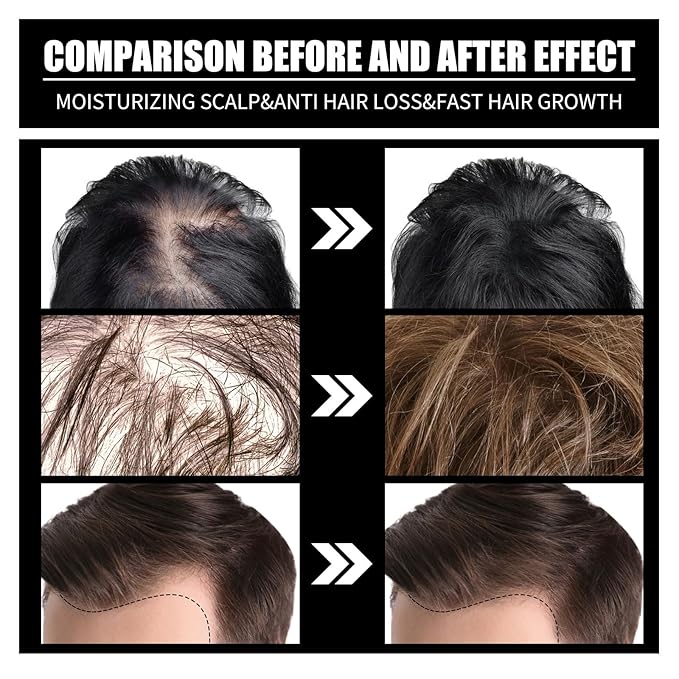 Hair Care Oil with Biotin and Collagen, Scalp Nourishing Treatment for Hair Loss Prevention and Root Strengthening, Suitable for Men and Women