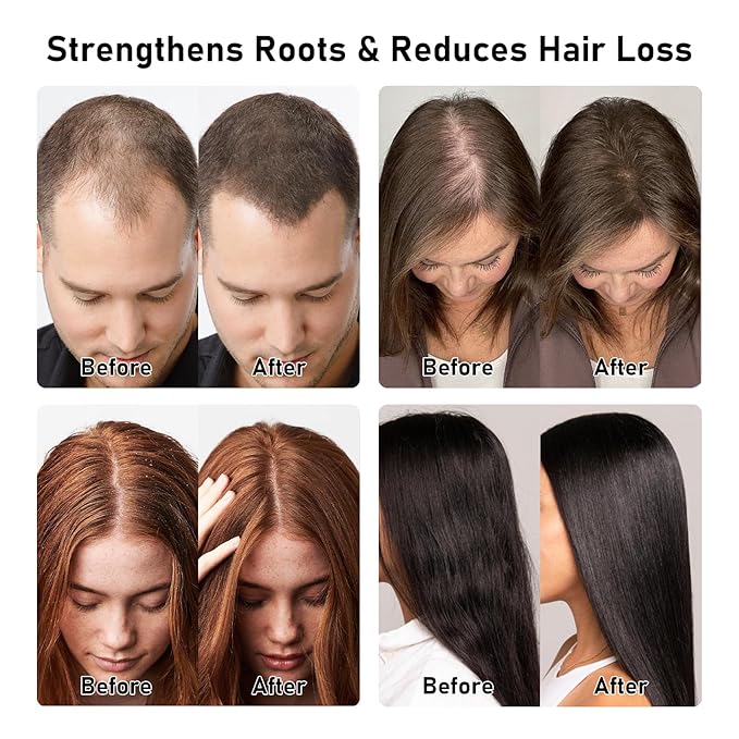 BANKIT Rosemary Batana Hair Growth Shampoo – Anti Hair Loss & Thickening Shampoo for Women & Men – Keratin Formula for Healthy Scalp & Fuller Hair(1 Pack)