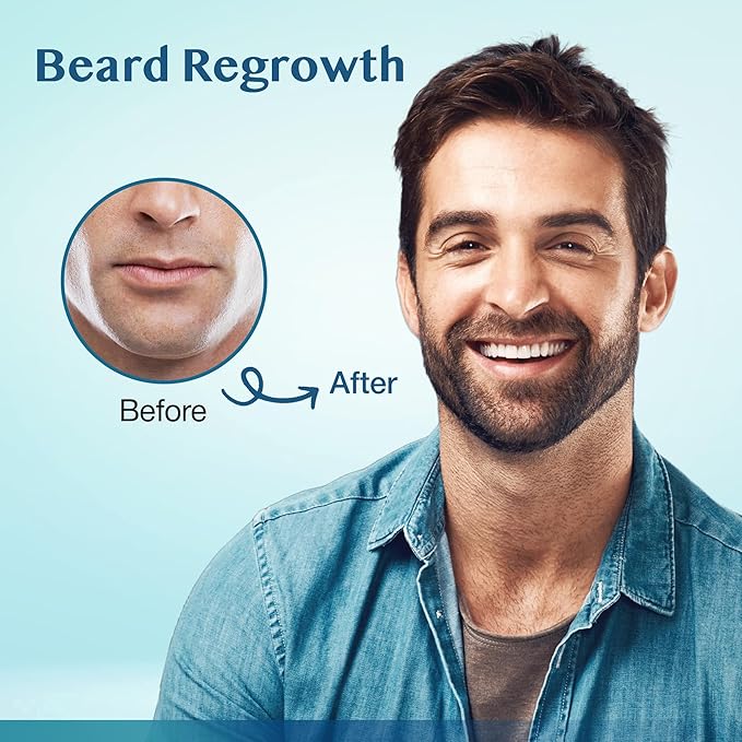 5% Minoxidil Hair Growth for Men and Women: Extra Strength Beard Regrowth Treatment Serum with Minoxidil and Biotin for Thinning Hair Loss to Grow Thicker Fuller 60ml 3 Bottles