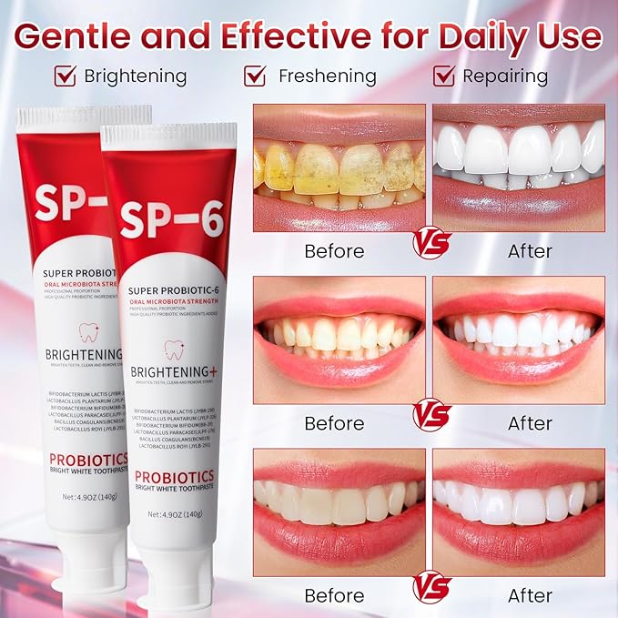 SP-6 Probiotic Whitening Toothpaste, SP-6 Probiotic Toothpaste, Enhanced Formula with 6 Probiotics for Teeth Whitening/Brightening, Enamel-Safe, Fluoride-Free, Fresh Mint Flavor, 4.9oz, 2Pack