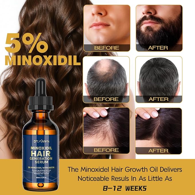 Hair Growth Serum 5% Minoxidil for Men Women with Biotin Castor Oil, Hair & Beard Care for Thinning Hair, Nourishing Scalp Treatment, 2.1FL OZ
