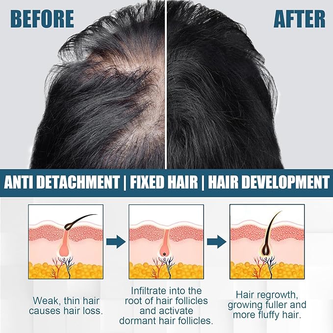 50ml Hair Growth Spray for Thinning Hair – Natural DHT Blocker with Ginseng & Biotin to Reduce Hair Loss, Stimulate Follicles & Regrow Fuller, Thicker Hair