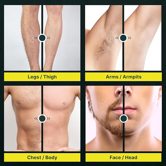 Asani Upkeeper Body Hair Trimmer & Groomer for Men – Rechargeable, Electric Razor-Shaver, Nick-Free Ceramic Blade, LED Light, IPX7 Waterproof, Groin, & Legs (Wet/Dry)