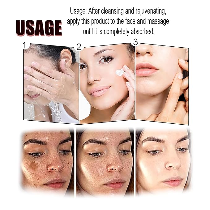 Generic Crema para Manchas Oscuras en La Cara, Dark Spot Remover for Face, Freckles Melasma Brown Spot Corrector for Men Women, Crema para Las Manchas de La Cara 20G