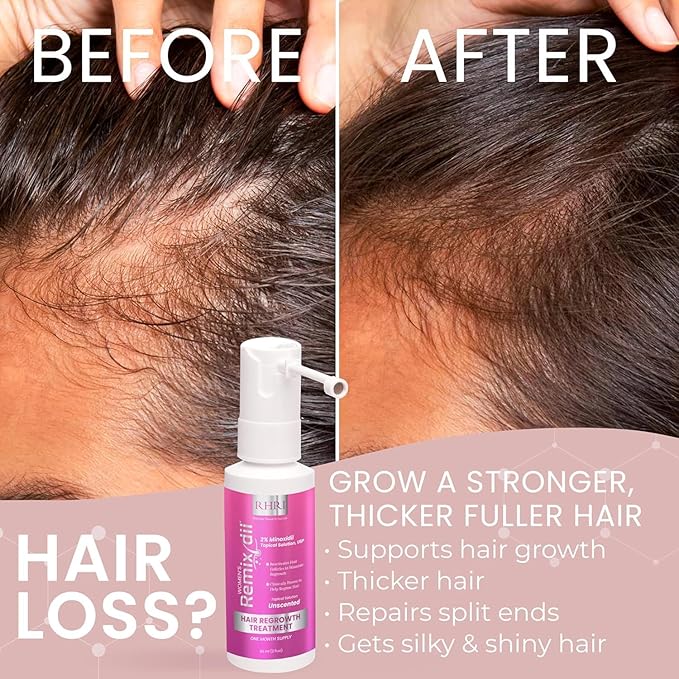 2% Minoxidil for Women Hair Regrowth Spray– Minoxidil Thicker & Fuller Topical Solution for Hair Loss Treatment, Follicle Reactivation - 60 ml (Pack of 2)