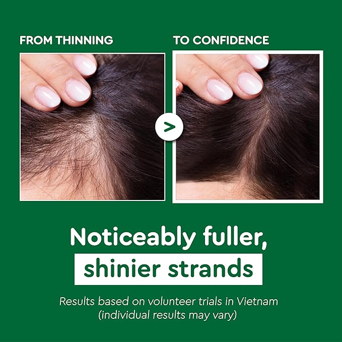 VIETNAM Hair Growth Shampoo for Thinning Hair, Shampoo for Hair Loss - 2 in1 Anti Hair Fall Shampoo & Conditioner, Strengthens Weak Roots for Thicker Fuller Hair with Polygonum Multiflorum (14.8 oz)