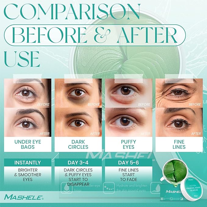 Korean 60pcs Aloe Vera Collagen Under Eye Gel Patches Mask, Treatment for Puffy Eyes, Dark Circles, Anti Wrinkle Pads, Moisturizing for Women and Men (60pcs patches aloe vera)