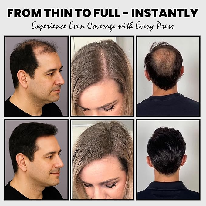 2PCS Hair Fibers for Thinning Hair - Hair Building Fibers Spray with Spray Applicator + Refill Pouch, Undetectable & Long-lasting, Instant Hair Coverage for Adults (Black, 30g+25g)