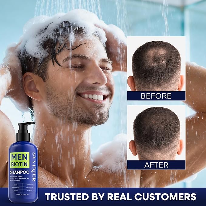 Svvimer Biotin Hair Growth Shampoo - Root Activator Thickening Shampoo for Men - With Rosemary Tea Tree Oil Caffeine For Hair Loss And Thinning Thickening - 13.5 Fl Oz (Pack Of 1)