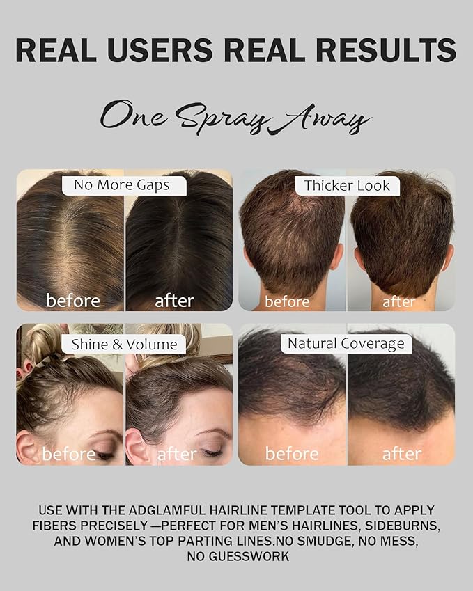 Hair Building Fibers for Thinning Hair, Root Touch Up Powder with Spray Applicator, Instant Volume & Hair Thickening for Men & Women, Sweatproof, Windproof, Matte Finish – 15g Dark Brown, No Residue