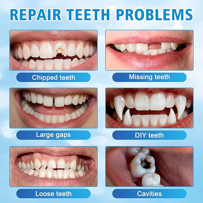 Tooth Repair Kit, Moldable False Teeth Beads, DIY Temporary Tooth Replacement Kit, Suitable for Missing, Broken and Chipped, Tooth Repair Beads Make You Smile Confidently-1PC