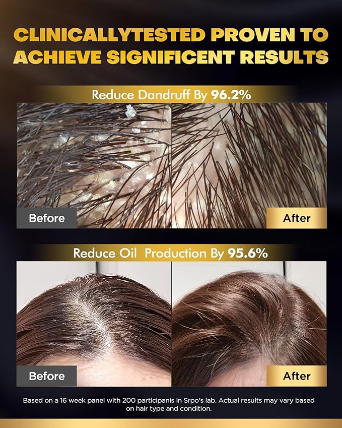 Tripeptide-Infused Biotin Hair Growth Shampoo and Conditioner Set, Onion Anti-Loss Volumizing Moisturizing Treatment for Soft Shine Hair, Rosemary Dandruff Routine Shampoo for Men and Women, 2x16.9oz