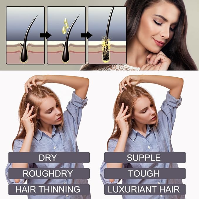 30ml Biotin & Collagen Hair Growth Oil - Scalp Treatment for Hair Loss, Anti Hair Loss Serum with Rosemary Oil & Vitamin E for Thinning Hair, Men & Women