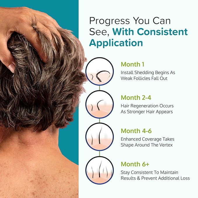 Minoxidil for Men Foam 5% - Unscented 3 Month Supply - Helps Restore Vertex Hair Loss & Thinning - 5% Minoxidil Foam For Men - Extra Strength Supports Hair Regrowth