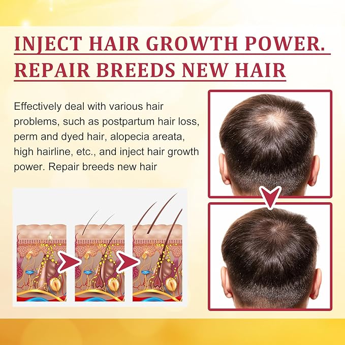 30ml Hair Growth Serum for Women & Men – Natural Plant-Based Formula with Ginseng & Ginger Oil to Reduce Hair Loss, Thicken Hair, and Stimulate New Growth