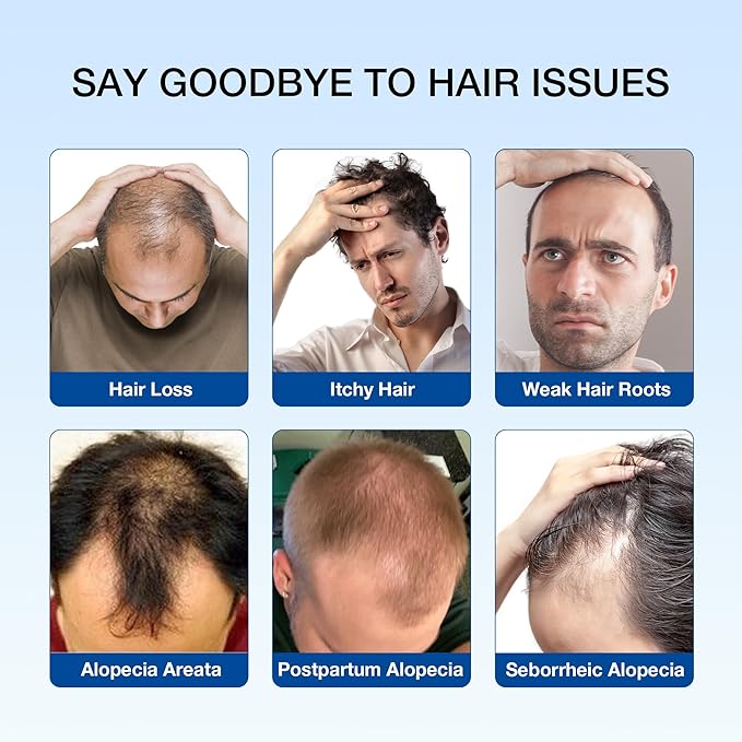 Professional Strength Hair Restore Shampoo for Hair Loss and Thinning Hair, DHT Blocker for Men and Women, Biotin Shampoo Infused with Rosemary Oil for Hair Growth, Sulfate-Free, Color-Safe, 16 Fl Oz
