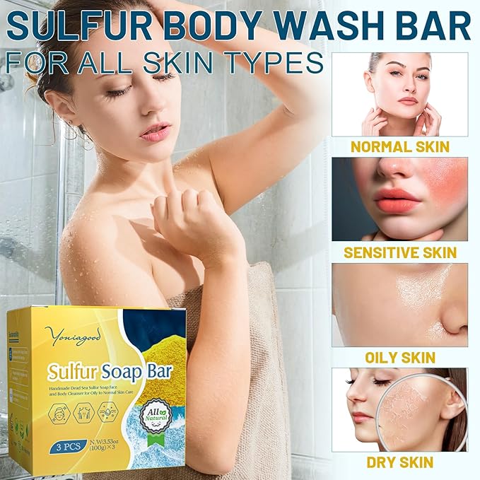 3 PCS Sulfur Dead Sea Soap, Natural Sulphur Bar Soap with Dead Sea Salt, Tea Tree Oil, Face & Body Exfoliating & Moisturizing Bar for Men & Women All Skin Types