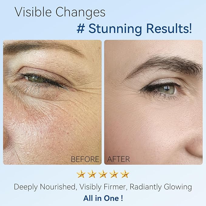 Retinol Moisturizer Face Cream with Hyaluronic Acid – Anti Aging & Hydrating Cream for Face, Neck, Chest & Body – Lightweight Instant Face Lift Cream, Gentle Formula for Men & Women, 1.35 FL OZ