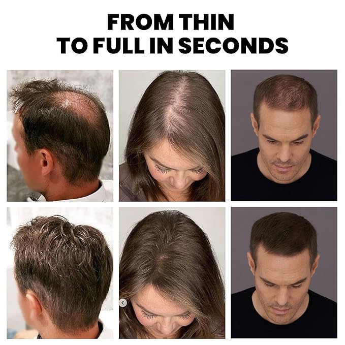 Hair Building Fibers & Hold Spray Set – Instant Hair Thickening for Thinning Hair, Natural Finish, Long-Lasting Coverage for Sparse Roots & Hairline, Grey (30g + 120ml)