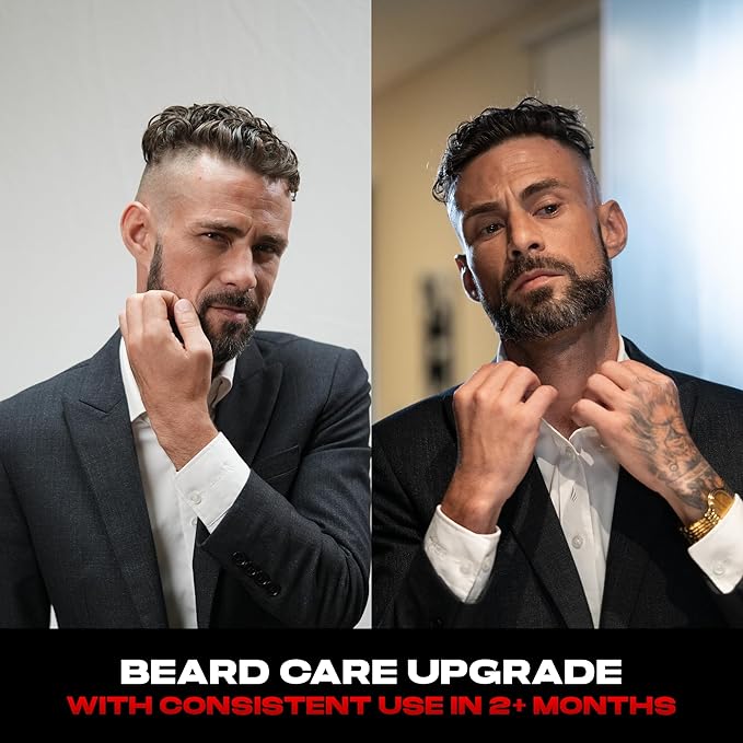 Beard Oil for Men using with Roller – Natural Beard Oil for Fuller Look, Softens & Conditions Facial Hair, Lightweight Grooming Gift, Christmas Gift for Men (1.7 fl oz)