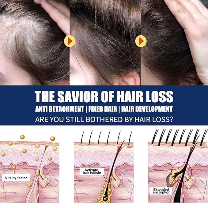 20g Hair Growth Cream for Thinning Hair – Stimulates Follicles, Reduces Hair Loss & Boosts Regrowth for Men and Women – Natural Scalp Treatment for Bald Spots & Receding Hairline