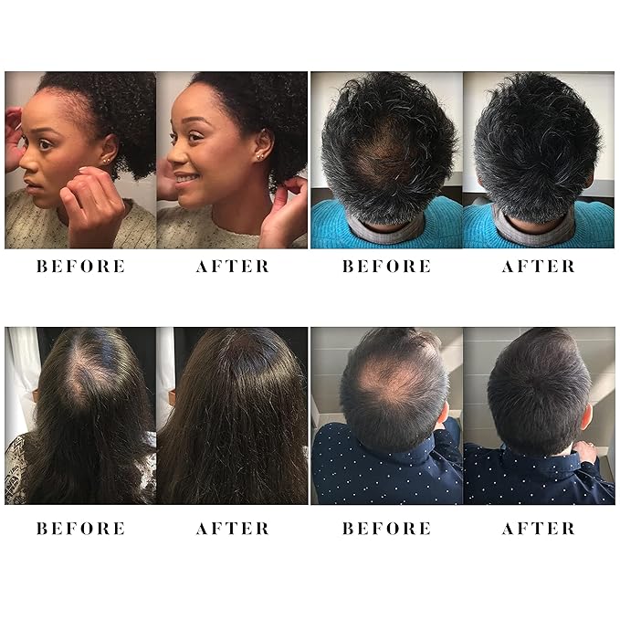 Alfy Hair Fibers for Thinning Hair - Premium Keratin Hair Building Fibers for Men & Women - Helps Conceal Existing Bald Spots - (28g, Light Brown)