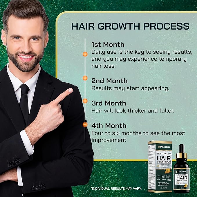 Minoxidil 5% Serum for Men and Women: Hair Growth Oil with Monoxide, Biotin, Beard Growth Kit - Minoxidil Serum - 1 Fl Oz - Prevent Hair Loss, Regrowth Treatment
