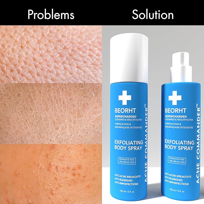Acne Body Spray for Back & Chest – Exfoliating Body Mist for Breakouts & Blemishes – Daily Clarifying Spray for Men & Women