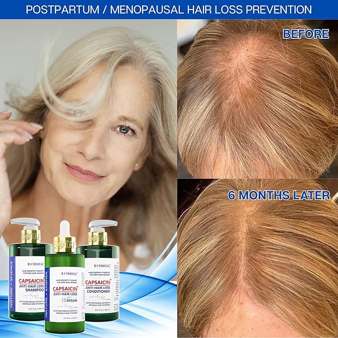 Botanical Capsaicin Shampoo for Hair Loss and Hair Thinning Oil-Free Scalp Stimulating Natural Shampoo For Men & Women 10.2 Fl Oz