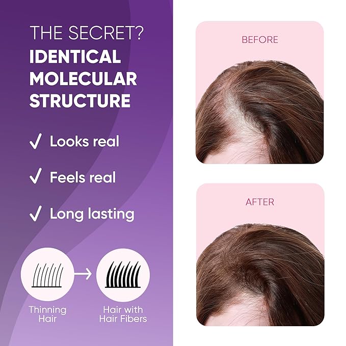 GBG Hair Fibers for Thinning Hair & Bald Spots (Black) - 25g Bottle - Conceals Hair Loss - Instant Cover Up & Volume in 30 Seconds, Hair Powder for Women & Men - Cruelty Free