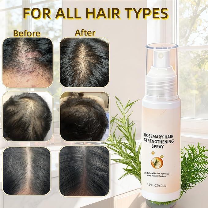 Hair Regrowth Spray, Unscented, 1.69 Fl Oz (Pack of 2), Liquid, for All Hair Types, Unisex Adult