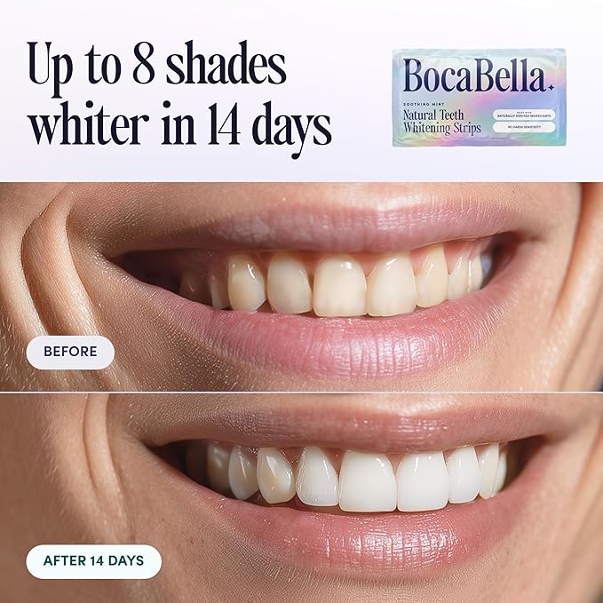 Teeth Whitening Strips for Sensitive Teeth – Natural, Peroxide-Free & Enamel-Safe | Clinically Tested Papaya & Pineapple Enzymes + Aloe & Coconut Oil | 7 Treatments for a Brighter, Whiter Smile