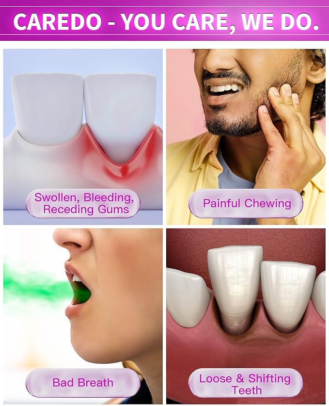 Gum Toothpaste for Periodontitis, Gum Repair for Receding Gums, Gum Disease & Gingivitis Treatment, Periodontal Disease Treatment for Gum Health, Gum Disease Repair Bad Breath Toothpaste 2 Pack
