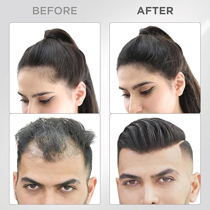 THICK FIBER Hair Fibers for Thinning Hair & Bald spots (BLACK, Pack of 2) - 25g Bottle - Conceals Hair Loss in Seconds - Hair Powder For Women & Men