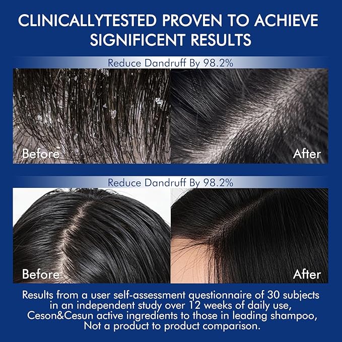 Ceson&Cesun Rosemary & Biotin Hair Growth Thickening Shampoo for Men | Anti-Thinning Hair Strengthening | Hydrate Cleanse Hair & Scalp | Hair Regrowth Shampoo, Dry Damaged Hair Care For Men and Women