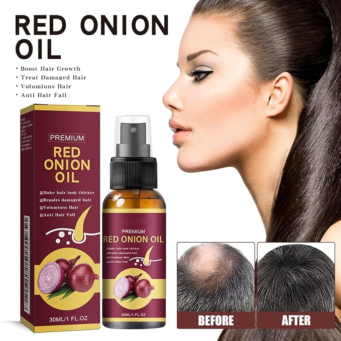 Red Onion Hair Growth Oil Spray for Hair Loss - Strengthens & Repairs Hair Follicles, Volumizes & Promotes Thicker Hair, Scalp Treatment for Men & Women, 30ml