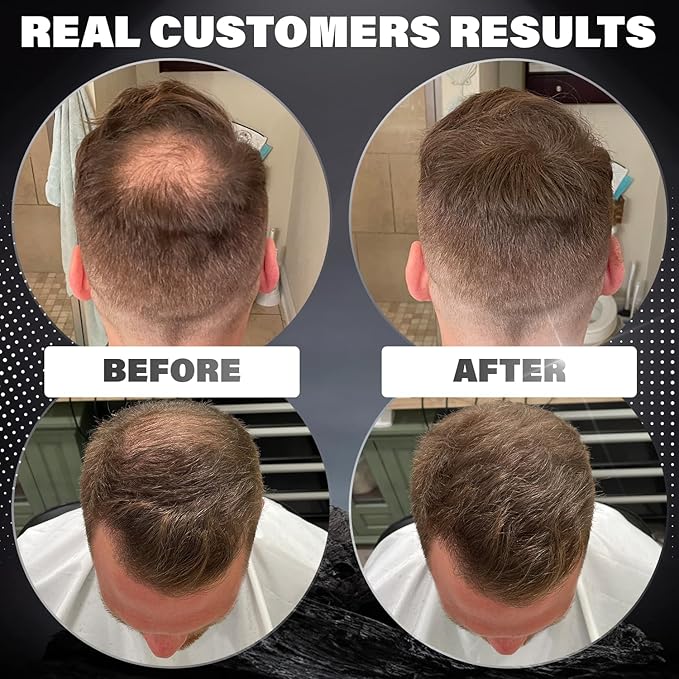 Fibers for Thinning Hair (Light Blonde), Undetectable Hair Powder for Men & 100% Natural Hair Building Fibers - Conceals Hair Loss - Bald Spot Cover Up Hair Powder, 2 Month Supply