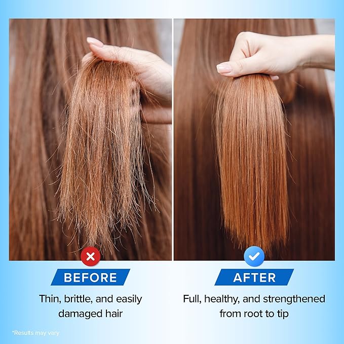Hair Growth Biotin Shampoo and Conditioner - Deep Hydrating Conditioner for Dry Damaged Hair, Sulfate Free & Volumizing - 2 Pack, 8oz