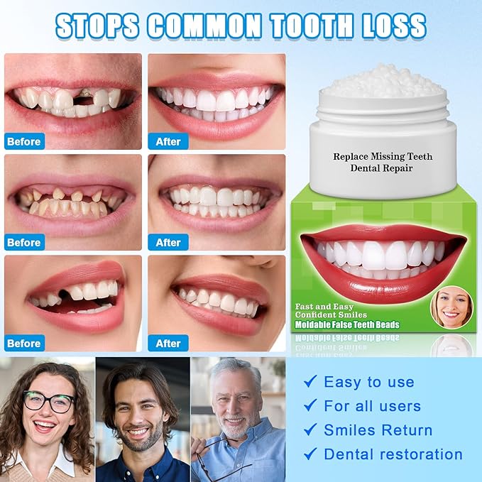 Moldable False Teeth Beads - Temporary Tooth Repair Kit | Fix Broken, Chipped Teeth, Cavity Temporary Fillings, Missing Tooth Gaps & Loose Dentures Within Minutes at Home