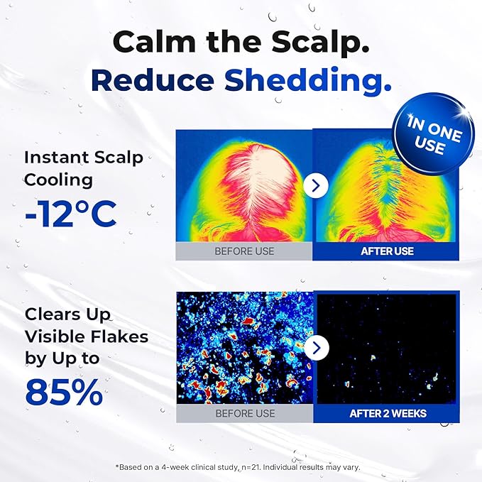 EPAIS Scalp Boosting Ampoule