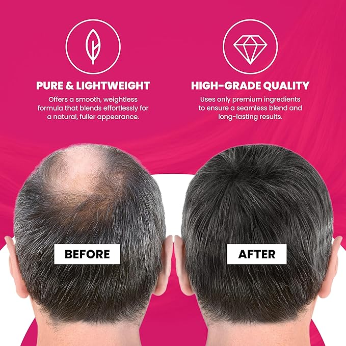 VELO Hair Building Fibers for Thinning Hair –LIGHT BLONDE Hair Fibers for Men & Women – Covers Bald Spots, Hairline Powder, Hair Thickening Fibers – Hair Filler Powder for Fuller-Looking Hair – 30g